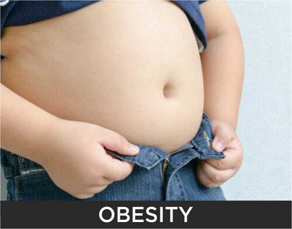 obesity